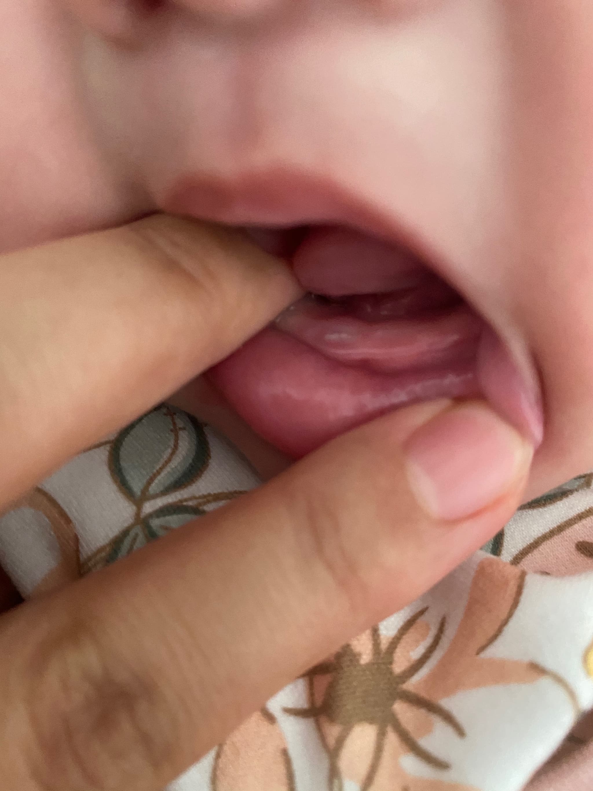 2024.9.29喜提第一颗乳牙